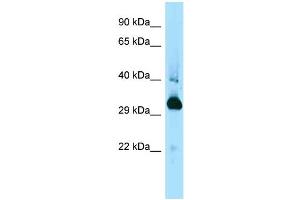 WB Suggested Anti-Mapre1 Antibody Titration: 1. (MAPRE1 antibody  (C-Term))