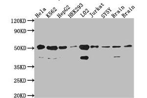 Western Blot Positive WB detected in: Hela whole cell lysate, K562 whole cell lysate, HepG2 whole cell lysate, HEK293 whole cell lysate, L02 whole cell lysate, Jurkat whole cell lysate, SH-SY5Y whole cell lysate, Mouse Brain whole cell lysate, Rat Brain cell lysate All lanes: RbAp48 antibody at 1:1000 Secondary Goat polyclonal to rabbit IgG at 1/50000 dilution Predicted band size: 48, 48, 47, 44 kDa Observed band size: 53, 40 kDa (Recombinant Retinoblastoma Binding Protein 4 antibody)