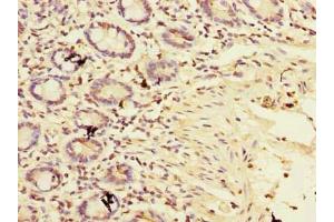 Immunohistochemistry of paraffin-embedded human small intestine tissue using ABIN7159912 at dilution of 1:100 (TIMM9 antibody  (AA 2-89))