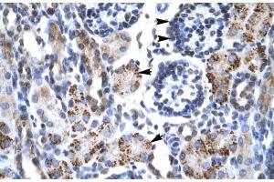Rabbit Anti-GFI1B Antibody Catalog Number: ARP30093 Paraffin Embedded Tissue: Human Kidney Cellular Data: Epithelial cells of renal tubule and renal corpuscle Antibody Concentration: 4. (GFI1B antibody  (N-Term))