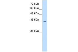 WB Suggested Anti-TRPM5 Antibody Titration:  0. (TRPM5 antibody  (N-Term))