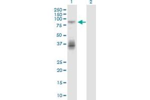 Western Blotting (WB) image for anti-Tumor Necrosis Factor Receptor Superfamily, Member 11a, NFKB Activator (TNFRSF11A) (AA 31-130) antibody (ABIN2565952)