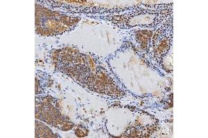 IHC analysis of Syntenin 2/SDCBP2 using anti-Syntenin 2/SDCBP2 antibody (ABIN7600017). (SDCBP2 antibody  (AA 14-292))