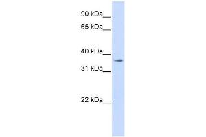 TMEM30B antibody used at 1 ug/ml to detect target protein. (TMEM30B antibody  (Middle Region))