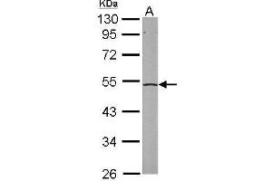 WB Image Sample (50 ug of whole cell lysate) A: mouse liver 10% SDS PAGE antibody diluted at 1:1000 (EIF2S2 antibody)