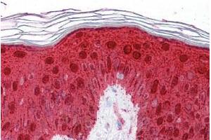 Human Skin: Formalin-Fixed, Paraffin-Embedded (FFPE) (14-3-3 sigma/SFN antibody  (AA 179-228))