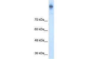 Western Blotting (WB) image for anti-Solute Carrier Family 12 (Potassium-Chloride Transporter) Member 2 (SLC12A2) antibody (ABIN2462733) (SLC12A2 antibody)