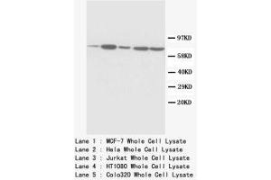Image no. 1 for anti-Succinate Dehydrogenase Complex, Subunit A, Flavoprotein (Fp) (SDHA) (C-Term) antibody (ABIN1493069) (SDHA antibody  (C-Term))