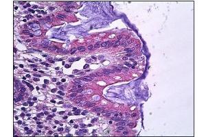 Human Colon, Epithelium: Formalin-Fixed, Paraffin-Embedded (FFPE) (SLC12A2 antibody)