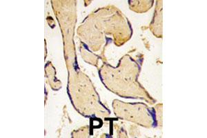 Formalin-fixed and paraffin-embedded human placenta tissue reacted with EPHA3 polyclonal antibody , which was peroxidase-conjugated to the secondary antibody, followed by DAB staining.