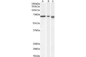 Western Blotting (WB) image for anti-Apoptosis-Inducing Factor, Mitochondrion-Associated, 1 (AIFM1) (C-Term) antibody (ABIN2630015)