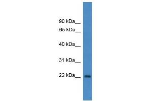 WB Suggested Anti-OTUB2 Antibody Titration: 0. (OTUB2 antibody  (N-Term))