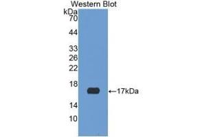 Detection of Recombinant NGB, Rat using Polyclonal Antibody to Neuroglobin (NGB) (Neuroglobin antibody)