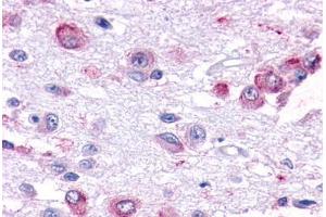 Human Brain, Hypothalamus (formalin-fixed, paraffin-embedded) stained with GPR101 antibody ABIN291950 at 7. (GPR101 antibody  (Cytoplasmic Domain))