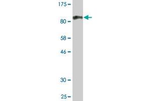 Western Blot detection against Immunogen (98. (RARS antibody  (AA 1-660))