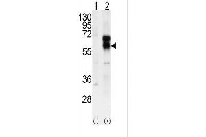 Western blot analysis of ACVRL1 using rabbit polyclonal ACVRL1 Antibody using 293 cell lysates (2 ug/lane) either nontransfected (Lane 1) or transiently transfected with the ACVRL1 gene (Lane 2).
