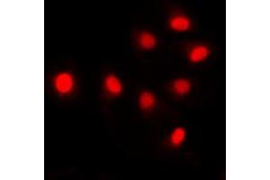 Immunofluorescent analysis of SIN3B staining in HCT116 cells. (SIN3B antibody  (Center))