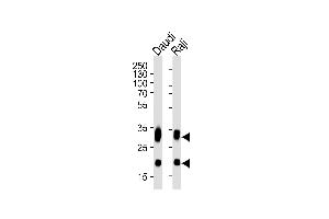 Western blot analysis of lysates from Daudi, Raji cell line (from left to right), using CD74 Antibody (ABIN1944838 and ABIN2838498). (CD74 antibody  (AA 1-232))