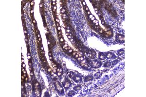 Immunohistochemistry (IHC) image for anti-Guanine Deaminase (GDA) (AA 220-446) antibody (ABIN5693253)