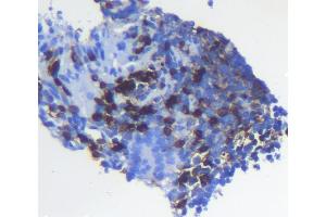 IHC analysis of CD5 using anti-CD5 antibody (ABIN7600839).