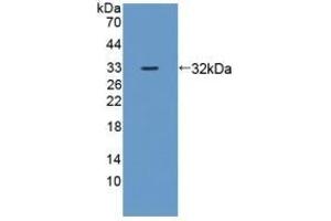 Detection of Recombinant ZRF1, Mouse using Polyclonal Antibody to Zuotin Related Factor 1 (ZRF1) (DNAJC2 antibody  (AA 368-621))