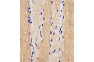 (ABIN6242880 and ABIN6578225) staining USP47 in human skeletal muscle tissue sections by Immunohistochemistry (IHC-P - paraformaldehyde-fixed, paraffin-embedded sections). (USP47 antibody  (AA 588-620))