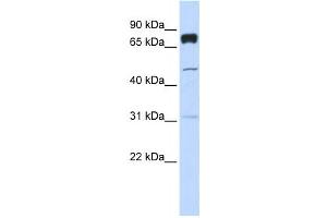 Western Blotting (WB) image for anti-Pleckstrin Homology Domain Containing, Family A (phosphoinositide Binding Specific) Member 4 (PLEKHA4) antibody (ABIN2458667)