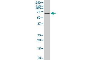 ATP6V1A polyclonal antibody (A01), Lot # 060717JCS1. (ATP6V1A antibody  (AA 508-617))