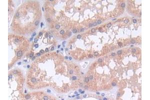 Immunohistochemistry (IHC) image for anti-Protein-tyrosine Phosphatase 1C (PTPN6) (AA 244-515) antibody (ABIN1870125)