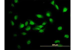 Immunofluorescence of monoclonal antibody to MDS028 on HeLa cell. (ITFG2 antibody  (AA 1-447))