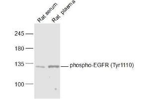 Lane 1: Rat serum lysates Lane 2: Rat plasma lysates probed with phospho-EGFR (Tyr1110) Polyclonal Antibody, Unconjugated  at 1:1000 dilution and 4˚C overnight incubation. (EGFR antibody  (pTyr1110))