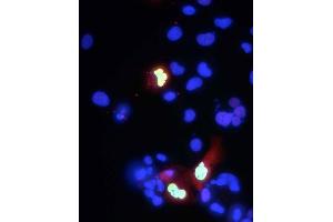 Transfected cell immunofluorescence: COS-1 cells expressing myc-tagged human Co-Rest. (CoREST antibody  (AA 109-293))