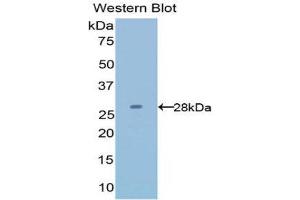 Western Blotting (WB) image for anti-Latexin (LXN) (AA 1-222) antibody (ABIN1078269) (Latexin antibody  (AA 1-222))