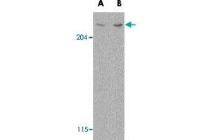 Western blot analysis of MTOR in L1210 cell lysate with MTOR polyclonal antibody  at (A) 1 and (B) 2 ug/mL . (MTOR antibody  (N-Term))