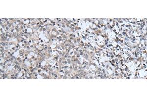 Immunohistochemistry of paraffin-embedded Human tonsil tissue using ABCA6 Polyclonal Antibody at dilution of 1:40(x200) (ABCA6 antibody)