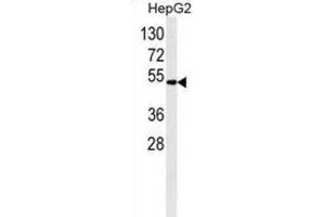 Western Blotting (WB) image for anti-Aldehyde Dehydrogenase 2 Family (Mitochondrial) (ALDH2) antibody (ABIN2995313)