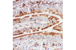 Anti-Hsp105 antibody, IHC(F) IHC(F): Rat Intestine Tissue (HSPH1 antibody  (C-Term))