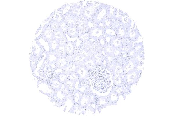 Recombinant PTH anticorps  (AA 1-34)