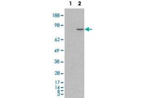 HEK293 overexpressing human CTNNA1 and probed with CTNNA1 polyclonal antibody  (mock transfection in first lane), tested by Origene. (CTNNA1 antibody  (Internal Region))