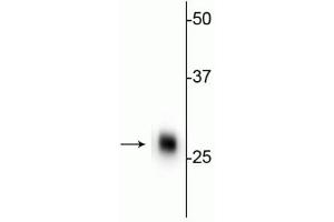 Western Blotting (WB) image for anti-Calbindin (CALB1) antibody (ABIN6254097)