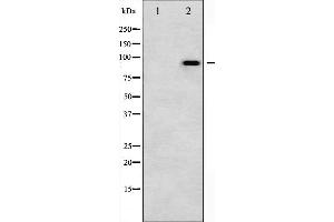 Western blot analysis of Catenin- beta phosphorylation expression in UV treated COS7 whole cell lysates,The lane on the left is treated with the antigen-specific peptide. (CTNNB1 antibody  (pTyr489))