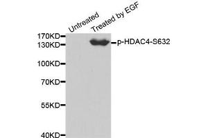 Western blot analysis of extracts from 293 cells using Phospho-HDAC4-S632 antibody. (HDAC4 antibody  (pSer632))