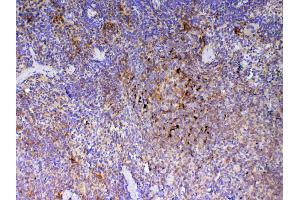 IHC analysis of ICOS using anti-ICOS antibody . (ICOS antibody  (AA 21-200))