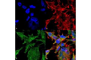 Immunocytochemistry/Immunofluorescence analysis using Mouse Anti-VAChT Monoclonal Antibody, Clone S6-38 . (SLC18A3 antibody  (AA 521-532) (PE))