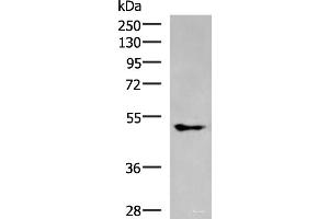 Western blot analysis of A549 cell lysate using KCNJ2 Polyclonal Antibody at dilution of 1:550 (KCNJ2 antibody)