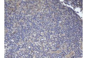 Image no. 2 for anti-B-Cell CLL/lymphoma 10 (BCL10) antibody (ABIN1496847) (BCL10 antibody)