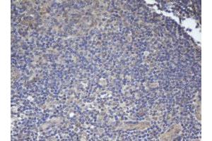Image no. 2 for anti-B-Cell CLL/lymphoma 10 (BCL10) antibody (ABIN1496847)