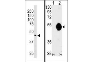 Image no. 1 for anti-DOK2 (DOK2) (C-Term) antibody (ABIN359960) (DOK2 antibody  (C-Term))