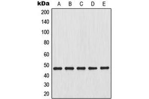 Western blot analysis of IKK beta expression in HeLa (A), HEK293T (B), mouse liver (C), mouse kidney (D), rat kidney (E) whole cell lysates. (IKBKB antibody  (N-Term))