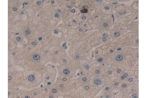 Detection of CASP5 in Human Liver Tissue using Polyclonal Antibody to Caspase 5 (CASP5)